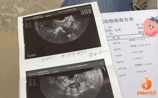 哪里有代妈[上海添喜助孕]+37岁试管的亲身经历，给你们个参考（二）